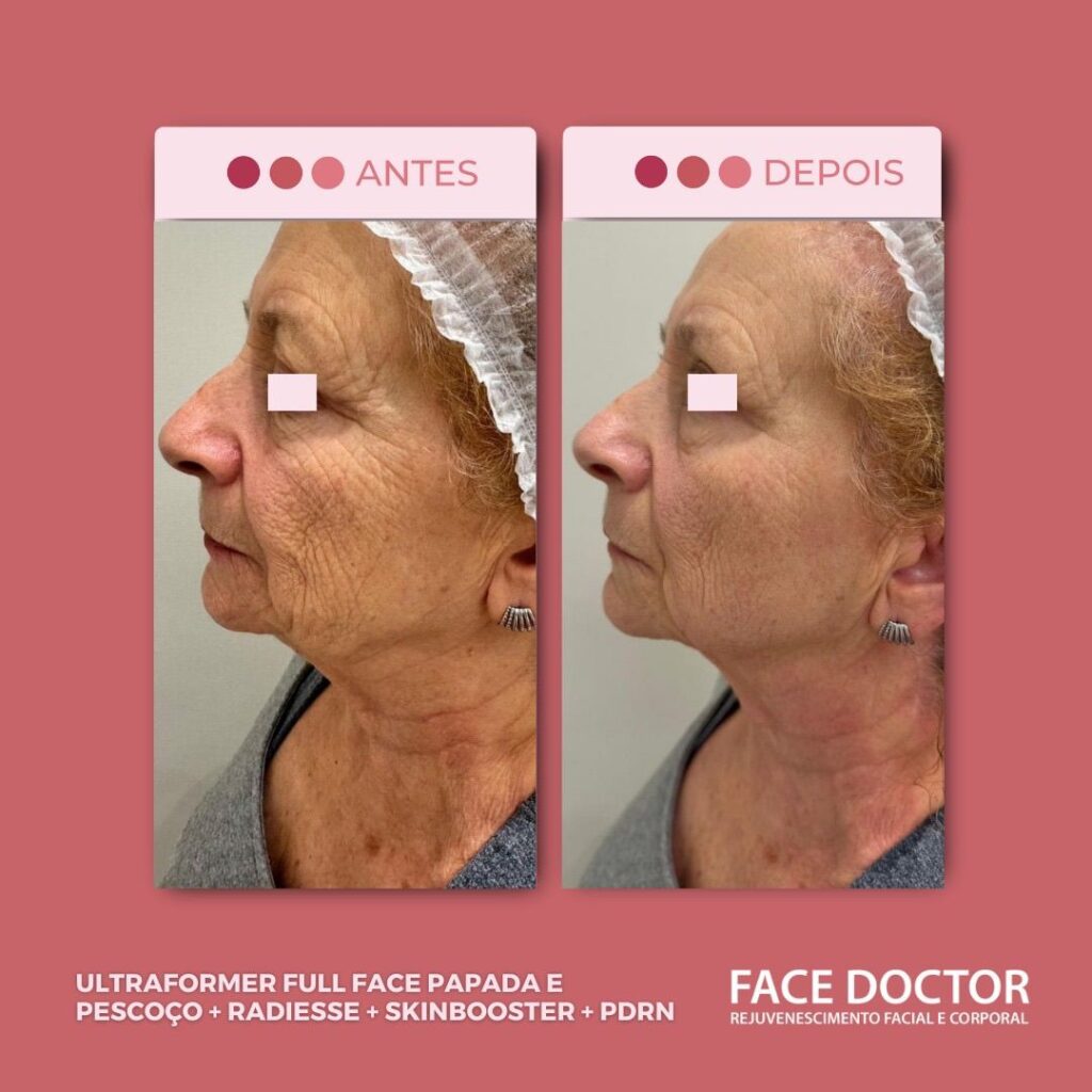 UF Full Face2